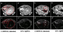 Desarrollan nanopartículas que mejoran el contraste en imágenes de resonancia magnética y facilitan el diagnóstico clínico