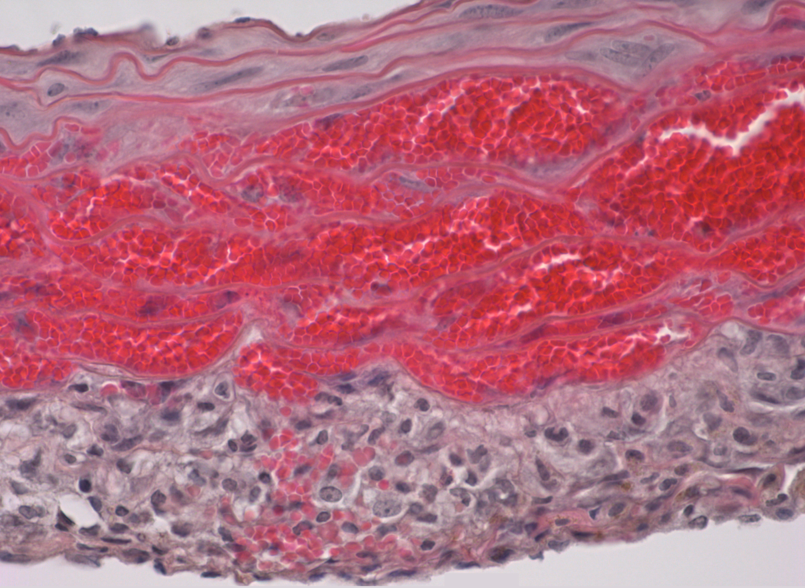 Prevenir la hipertensión con fármacos antihipertensivos evita la formación de una enfermedad vascular mortal