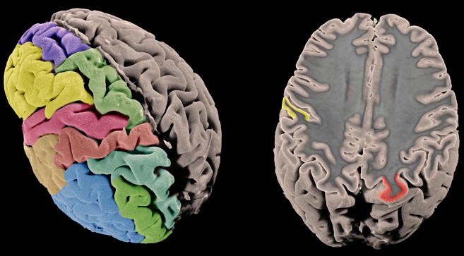 Avanzan en el conocimiento de la arquitectura genética de la corteza cerebral humana