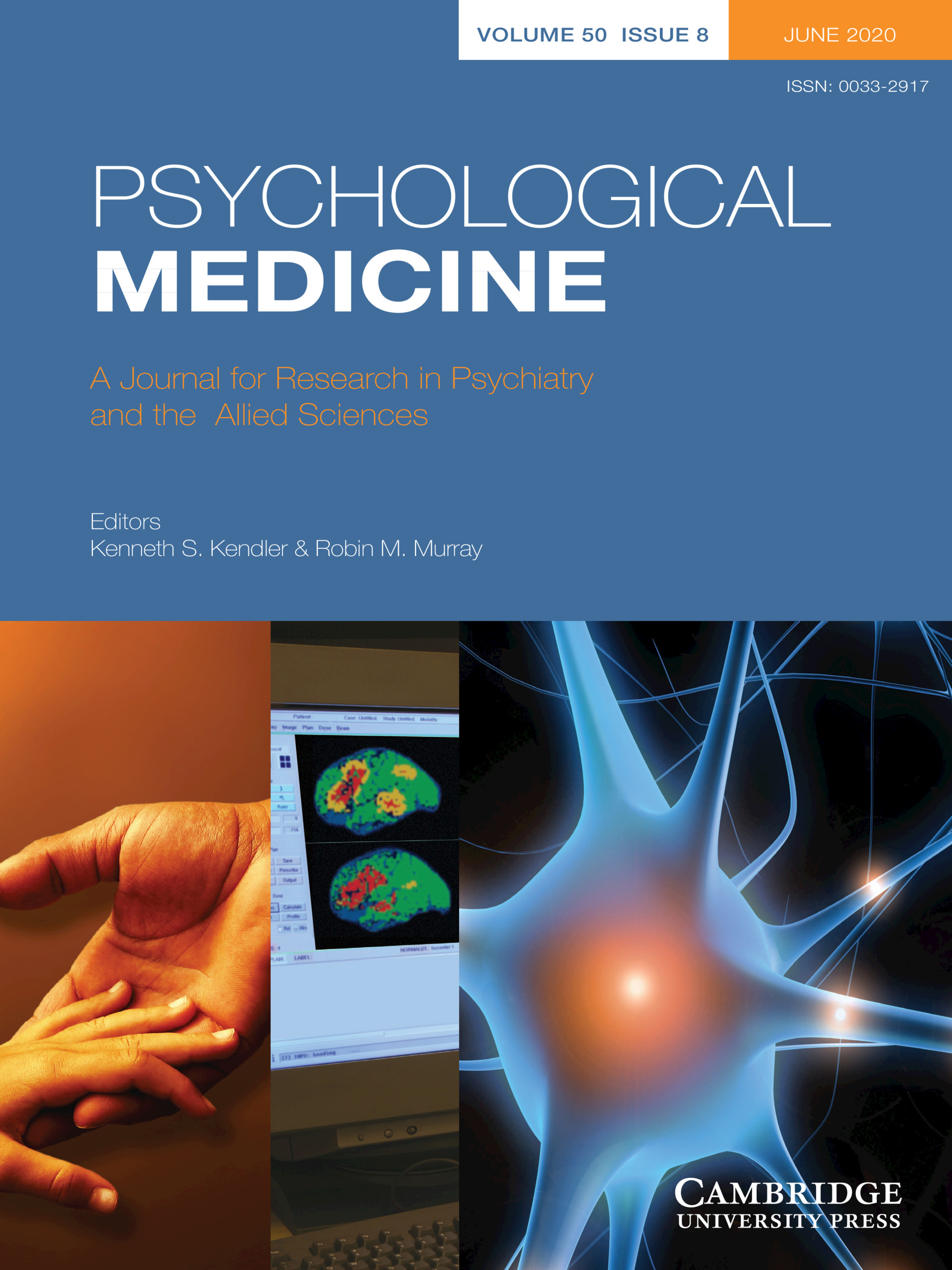 Identifican dos perfiles de rendimiento en cognición social en pacientes con trastorno bipolar
