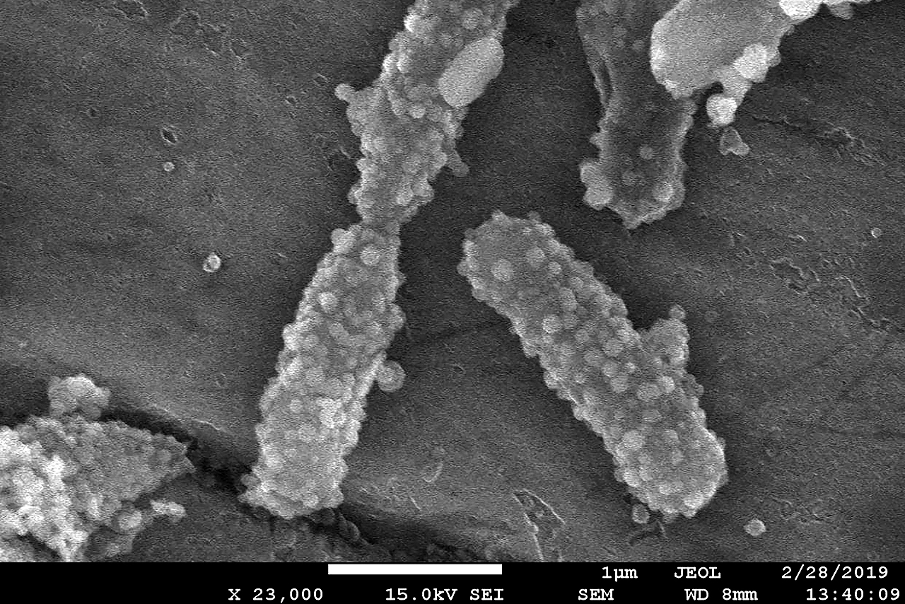 Bacterias para transportar nanopartículas cargadas con fármacos a tejidos tumorales