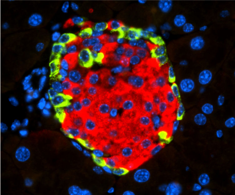 Describen cómo la infección por enterovirus puede inducir diabetes