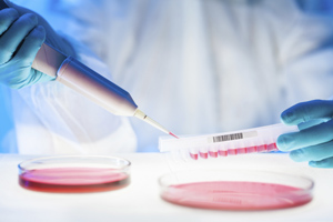 Algunos fármacos usados para disminuir el ácido del estómago podrían incrementar los falsos positivos en el cribado de cáncer de colon y recto