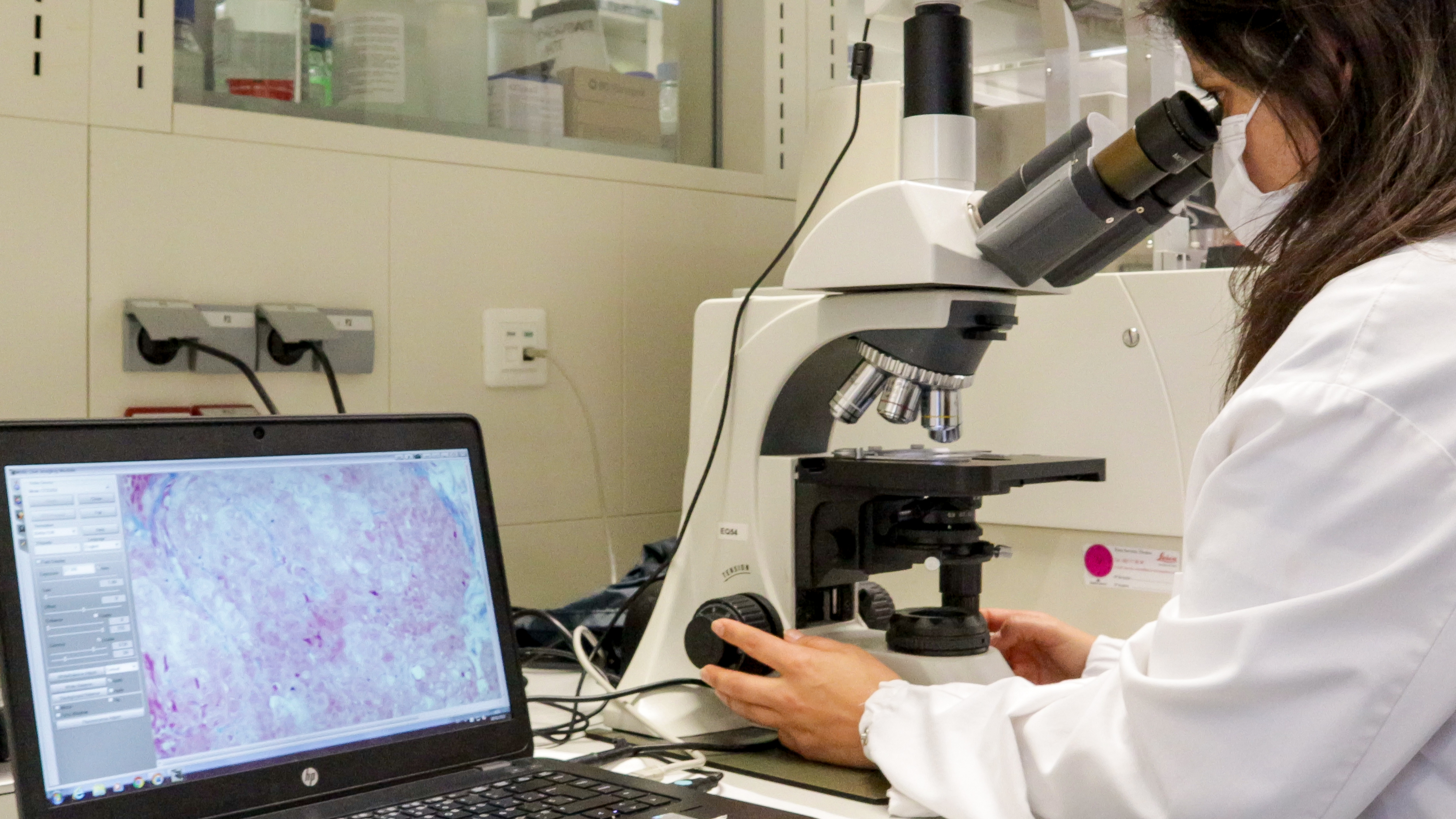 Desarrollado un nanomedicamento más eficaz para el tratamiento de la enfermedad rara de Fabry