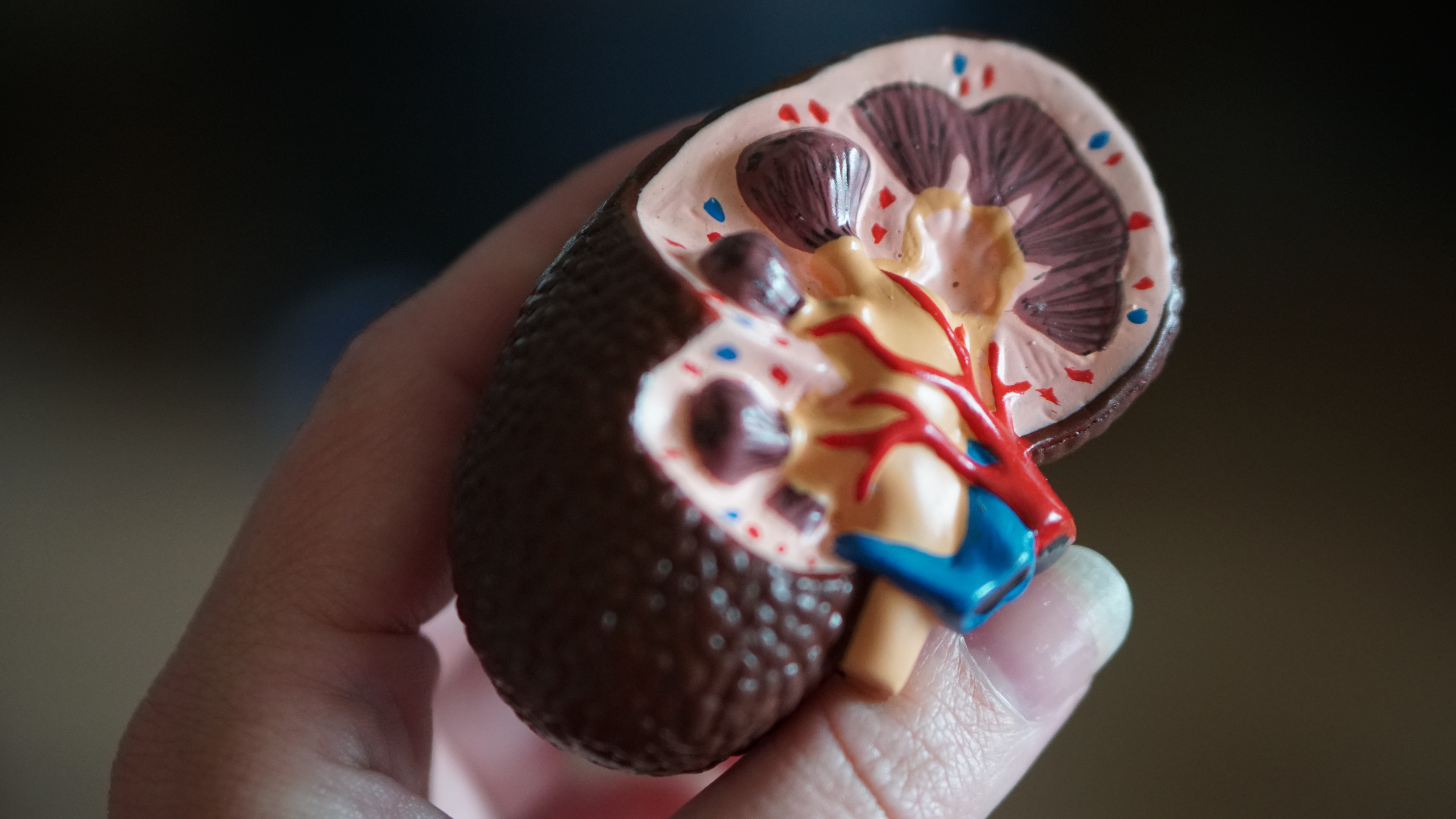 El tratamiento con calcitriol de pacientes con insuficiencia renal se asocia a una importante reducción de muerte por Covid-19