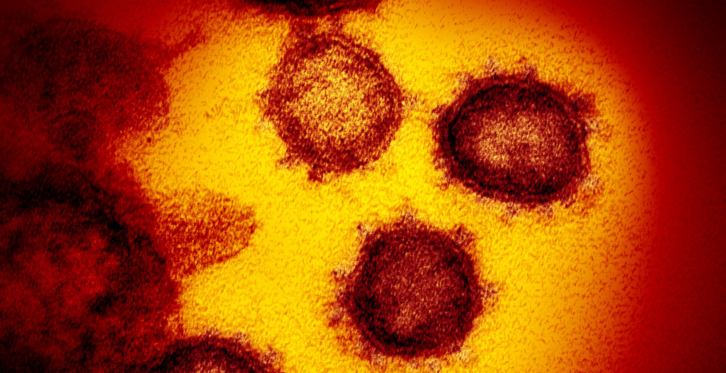 Una investigación revela que el 30% de infecciones por SARS-CoV-2 en la primera ola fueron asintomáticas
