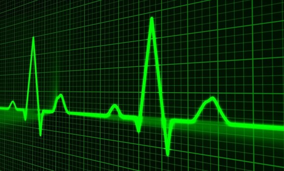 Un algoritmo incorporado en desfibriladores permite predecir descompensaciones de insuficiencia cardiaca de forma segura y actuar a distancia
