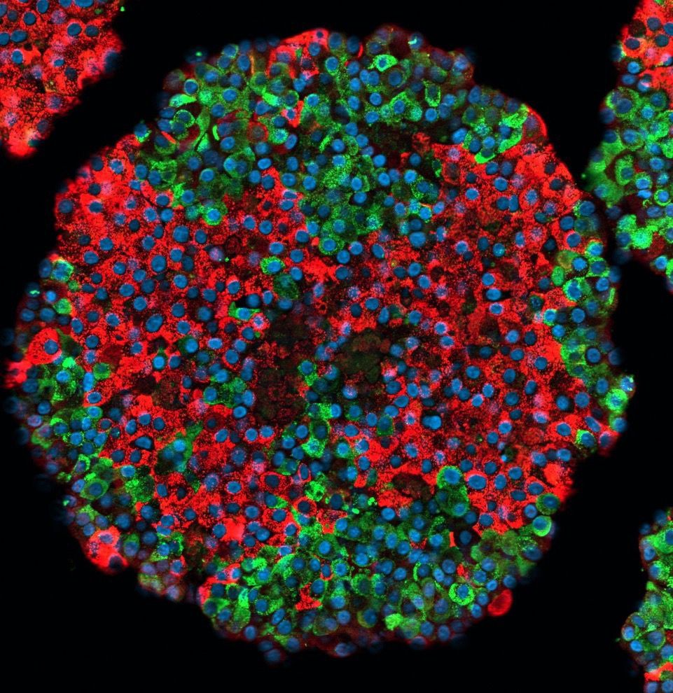 Generan células beta pancreáticas con elevada funcionalidad a partir de células madre