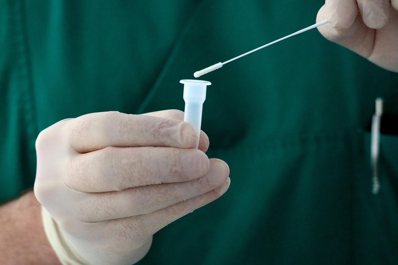 Los anticuerpos contra SARS-CoV2 se vuelven indetectables en más del 40% de los infectados transcurridos 7 meses de la infección
