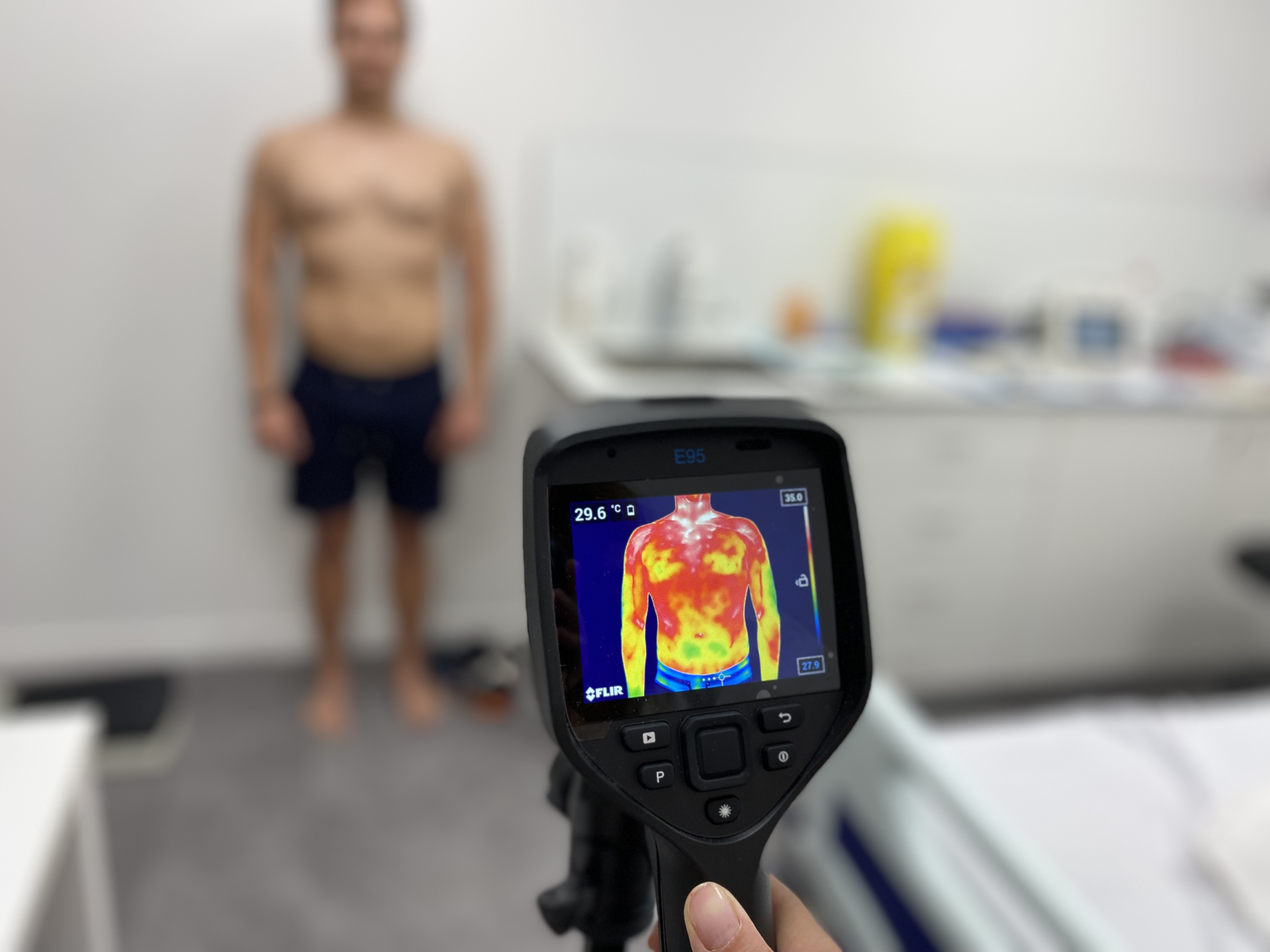 Descubren nuevas vías para el tratamiento de enfermedades inflamatorias intestinales como el Crohn