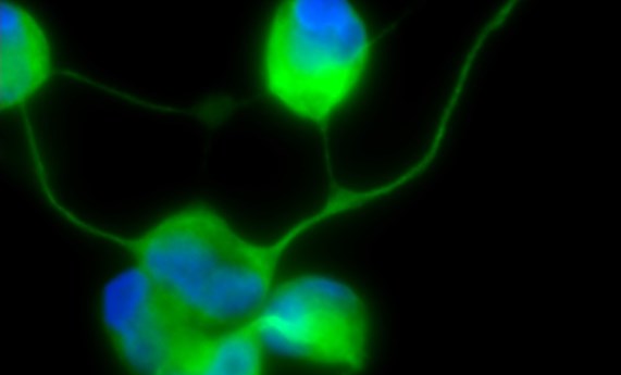 Generan neuronas mediante reprogramación directa de las células de la piel de pacientes mitocondriales con el síndrome MELAS