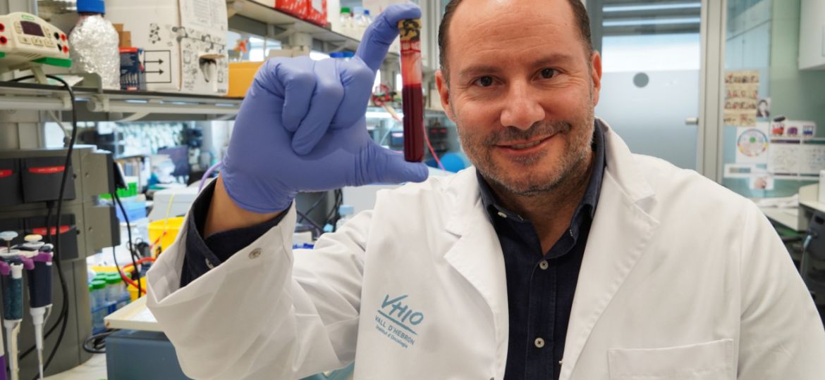 Desarrollan una nueva herramienta de biopsia líquida que aumenta un 30% la sensibilidad de detencción de ADN tumoral en plasma