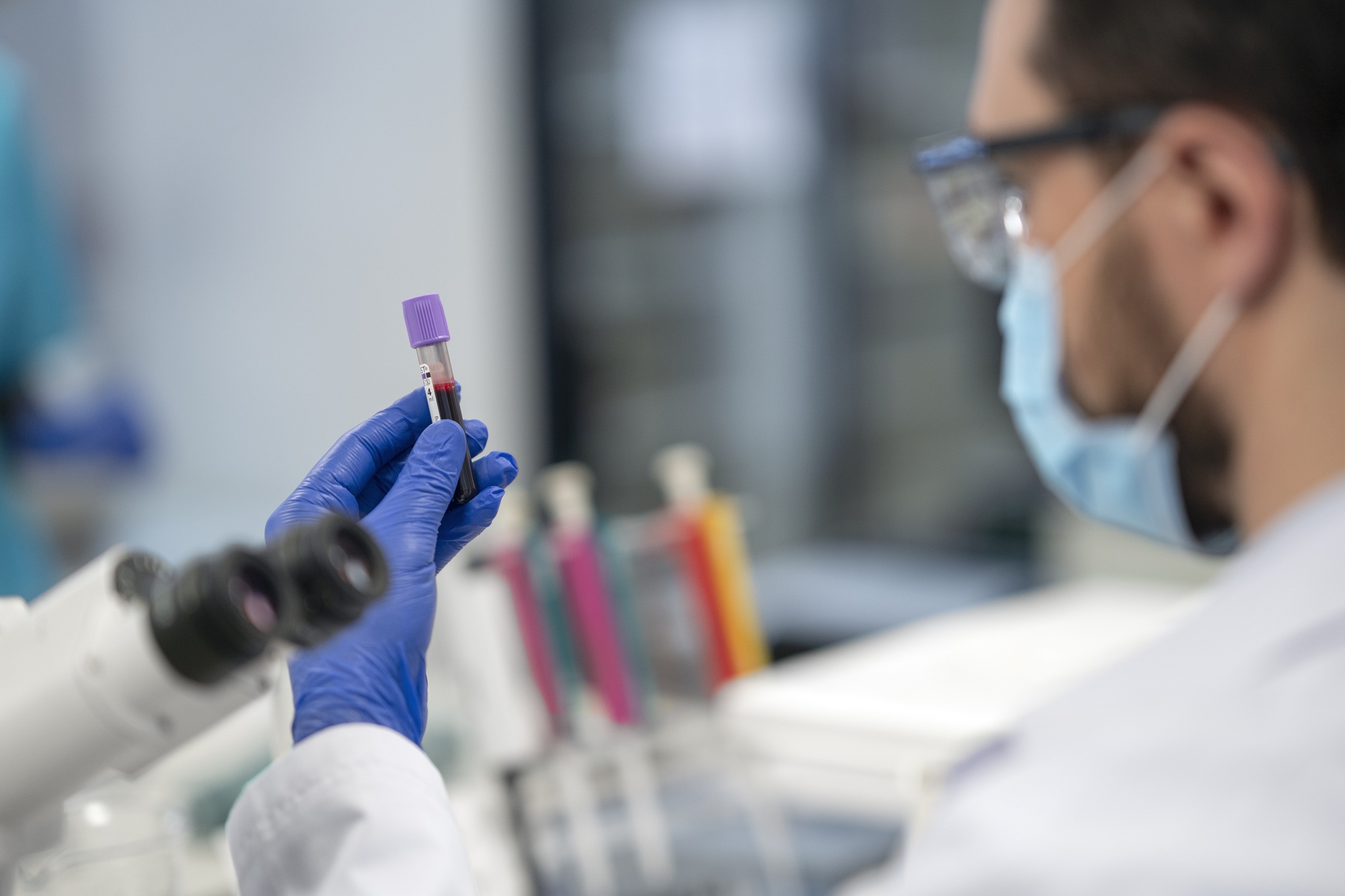 Niveles elevados de GDF15 podrían estar asociados con lesión hepática y aterosclerosis