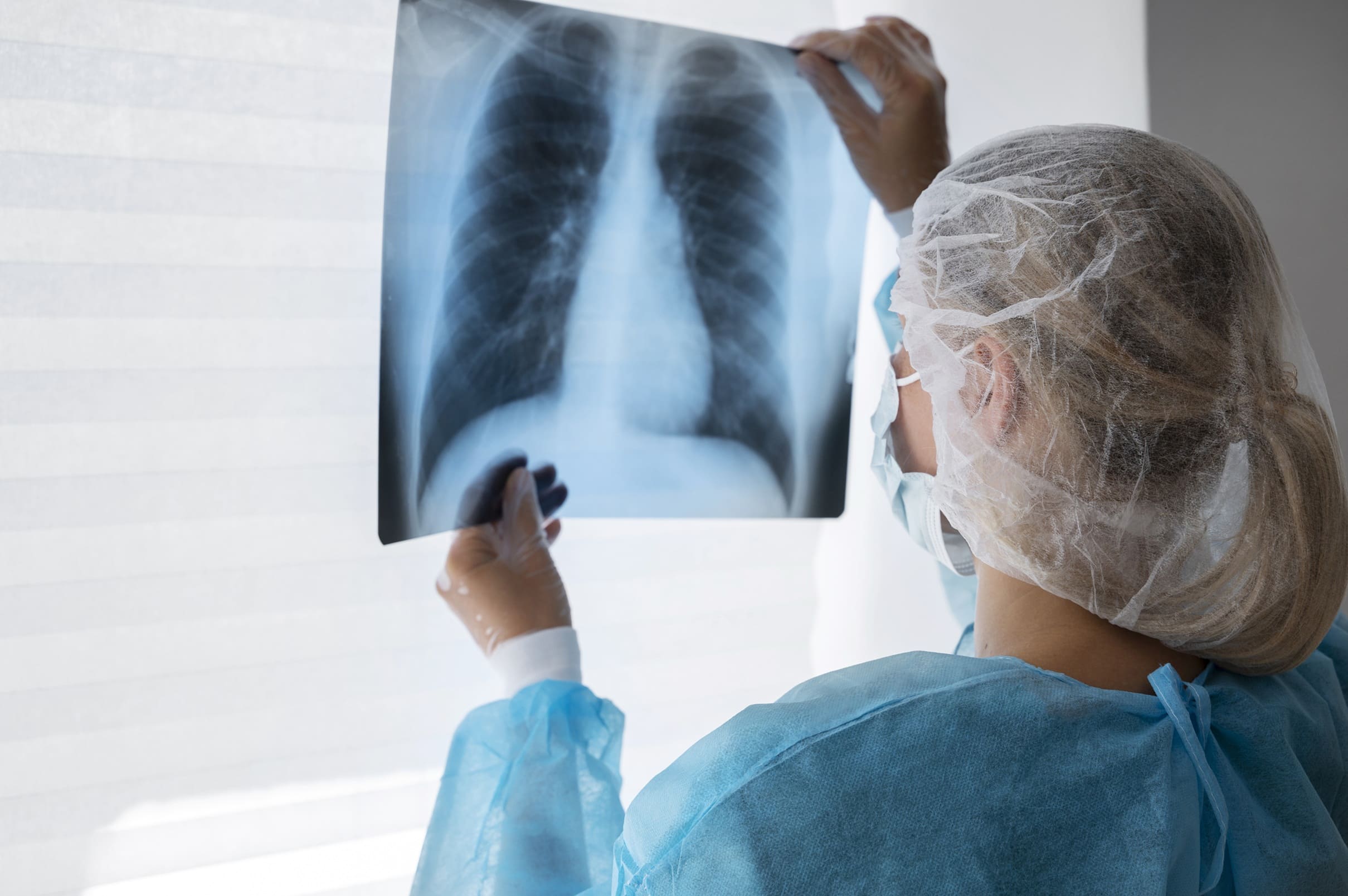 La IA ayuda a predecir la respuesta a inmunoterapia en cáncer de pulmón con datos reales de historia clínica y hemograma