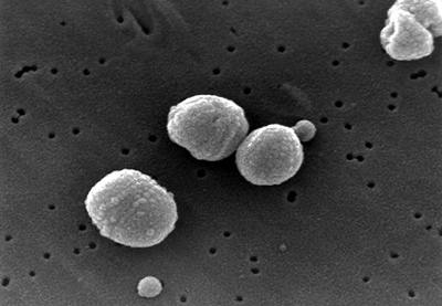 Un nuevo método para detectar neumococos ha obtenido la concesión de una patente en Estados Unidos